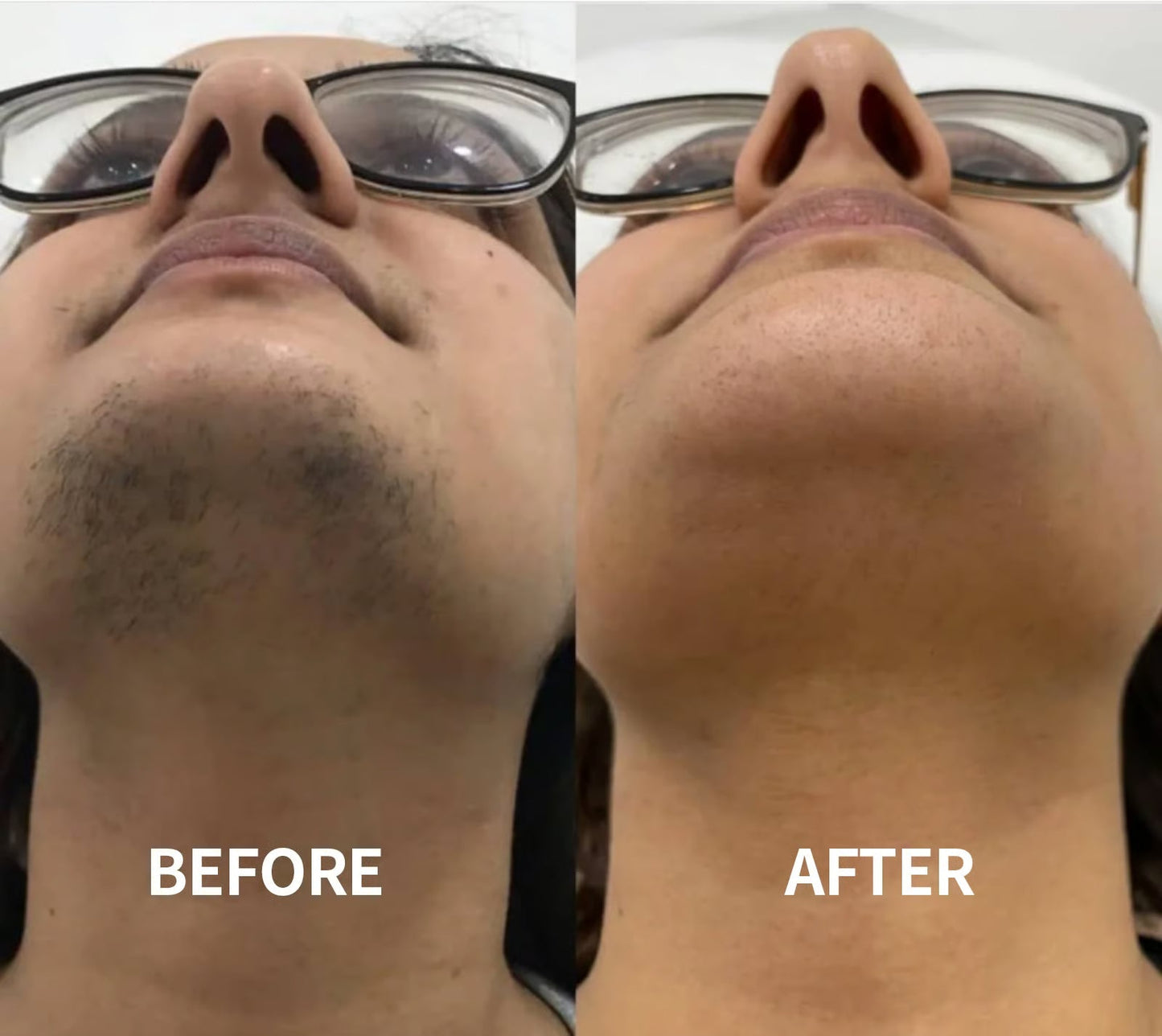 Facial Hair Removal Cream Gentle, Fast & Pain-Free Smoothness