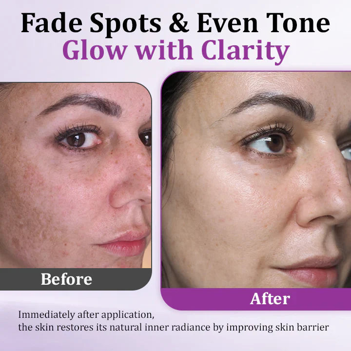 MelantraX Advanced Anti-Hyperpigmentation Essence