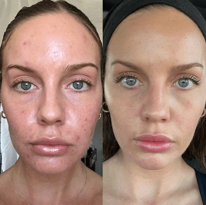 Orange Enzyme Exfoliating Gel – Smooth, Bright & Glowing Skin