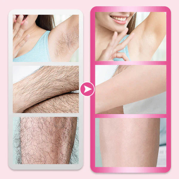 Gentle Hair Removal Cream – Smooth Skin Without the Pain